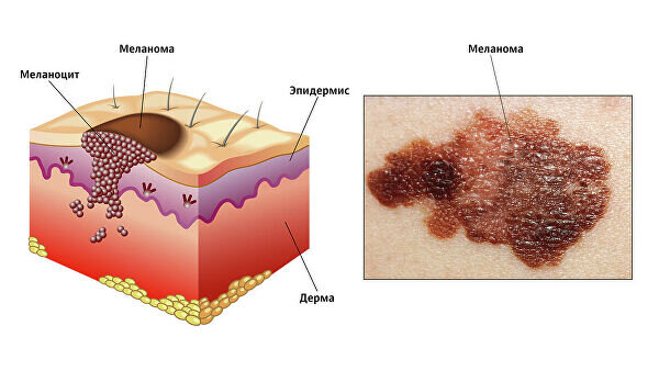 Иллюстрация взята с сайта РИА "Новости"