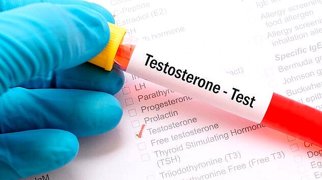 Как я определил понижение тестостерона. Главные сигналы
