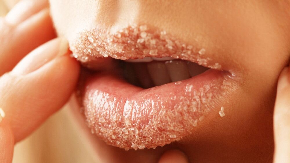 7 причин, почему трескаются губы – и как их быстро залечить