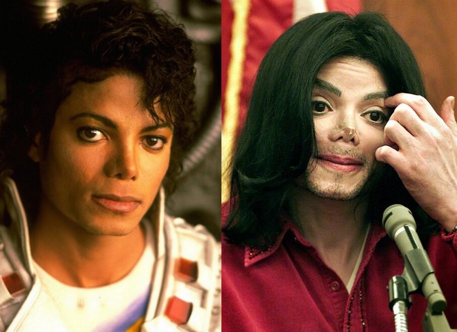 До и после пластических операций