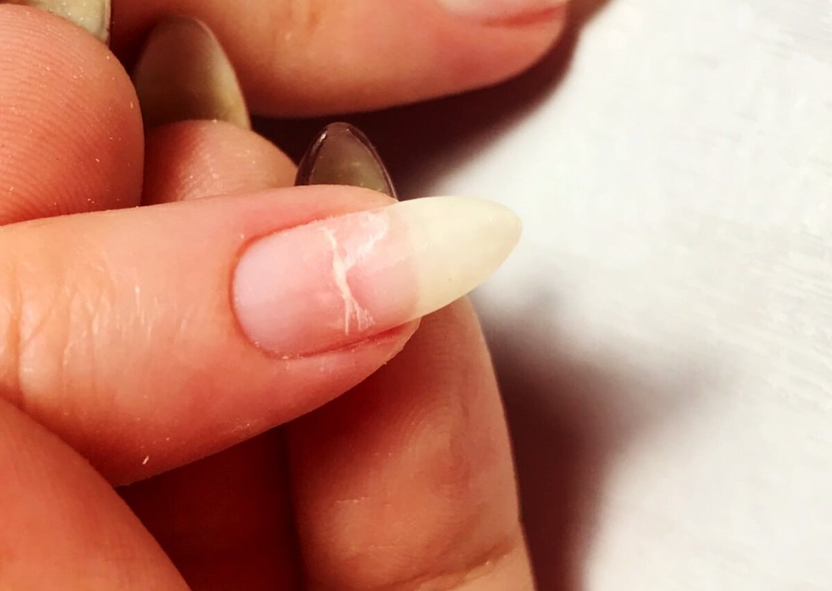 Причины ломкости ногтей и секреты ухода для укрепления ногтевой пластины