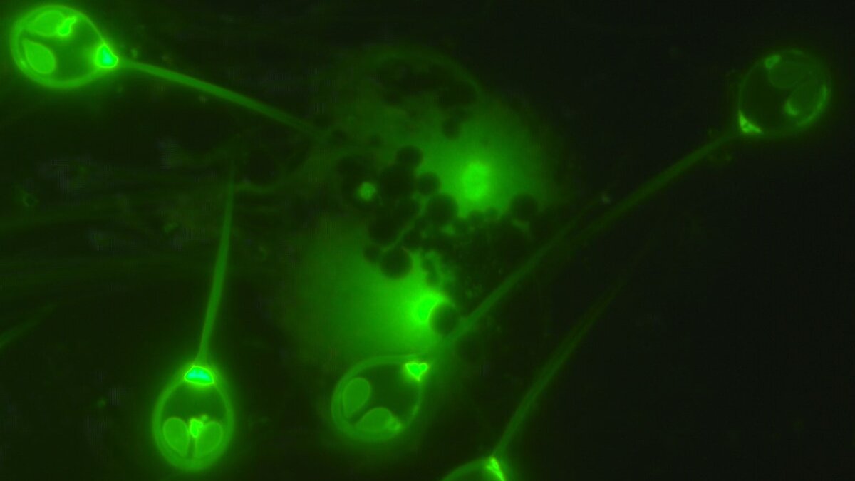 Споры H. salminicola под флуоресцентным микроскопом. Фото Stephen Douglas Atkinson.