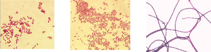         Escherichia coli                                     Brucella abortus                                  Bacillus anthracis                              
   (грамотрицательная)                  (грамотрицательная)                 (грамположительная)