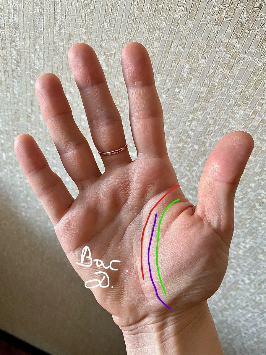 Тройная линия жизни