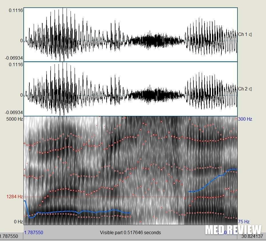 Цифровая обработка и анализ высоты голоса учеными Геттингенского университета