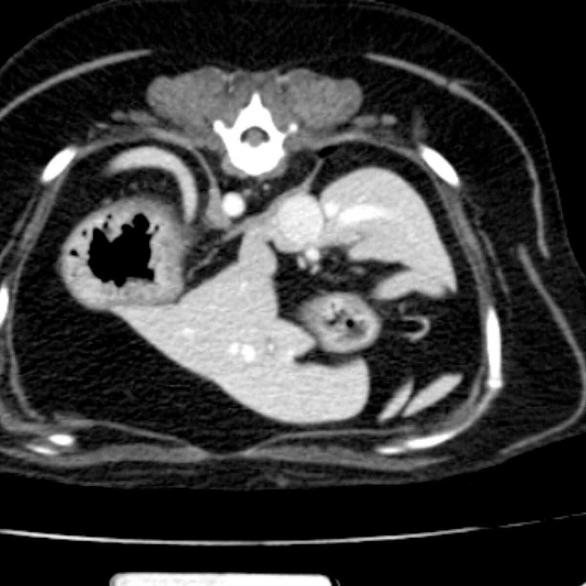 Компьютерная томография в онкологии (КТ онкопоиск) | Ветклиника ...