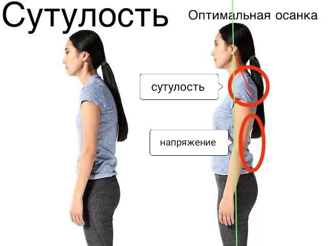 Фото «после» сделано искусственно: работа не была проведена, девушку просто попросили выпрямиться