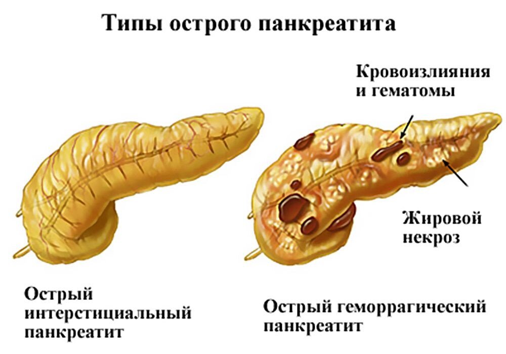 Иллюстрация взята с сайта яндекс Картинки