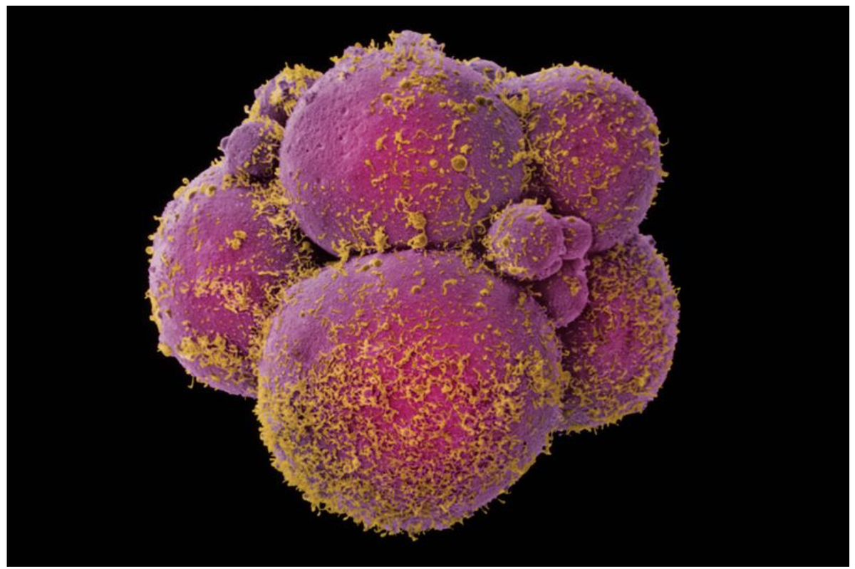 Человеческий эмбрион на стадии 8 клеток. Автор: Yorgos Nikas/SPL