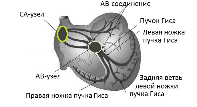 Блокада ножки пучка Гиса