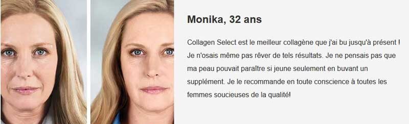 Результат использования Collagen Select