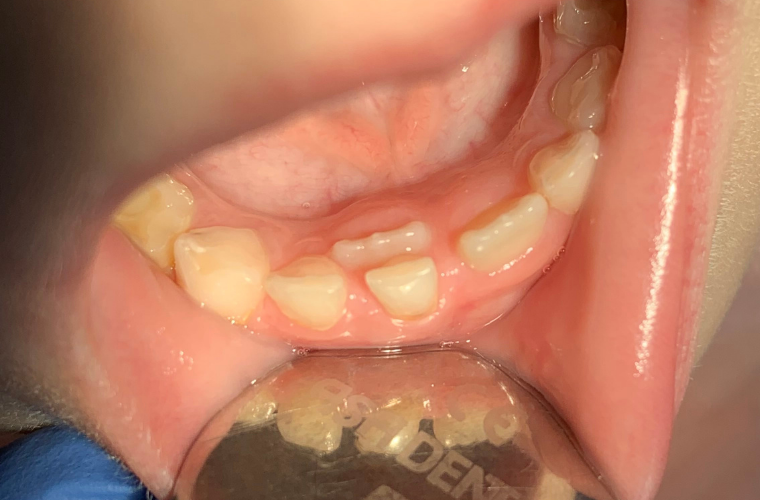 Самые задаваемые вопросы детскому стоматологу и ортодонту