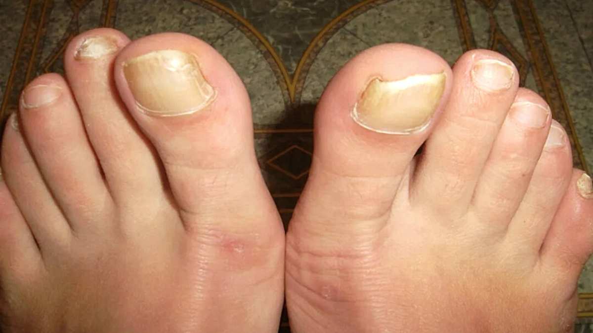 иллюстрация из интернета 