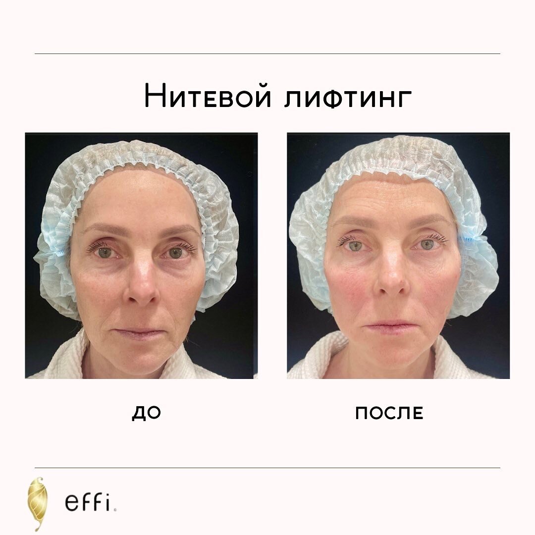 Клиника косметологии и пластической хирургии effi Красноярск