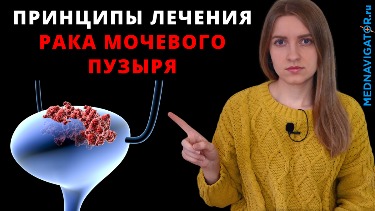 Все о лечении РАКА МОЧЕВОГО ПУЗЫРЯ - операция, лучевая, химио- и  иммунотерапия | Mednavigator.ru | Дзен