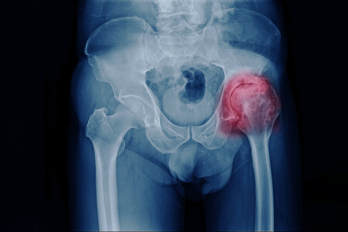 Изображение взято из свободного источника