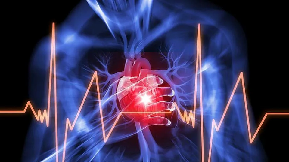 Сердцебиения 23. Нарушение ритма. Нарушение сердечного ритма. Сердечные аритмии. Заболевания сердца аритмия.
