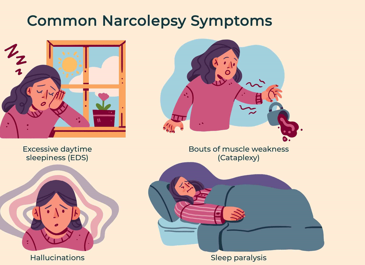 Me болезнь. Нарколепсия. Нарколепсия-катаплексия. Катаплексия у человека.