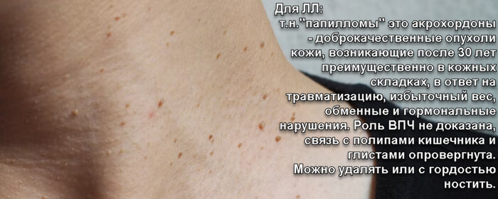 "Не виноватый я! Он сам растёт!"(c) Вирус папилломы человека | Пикабу ...