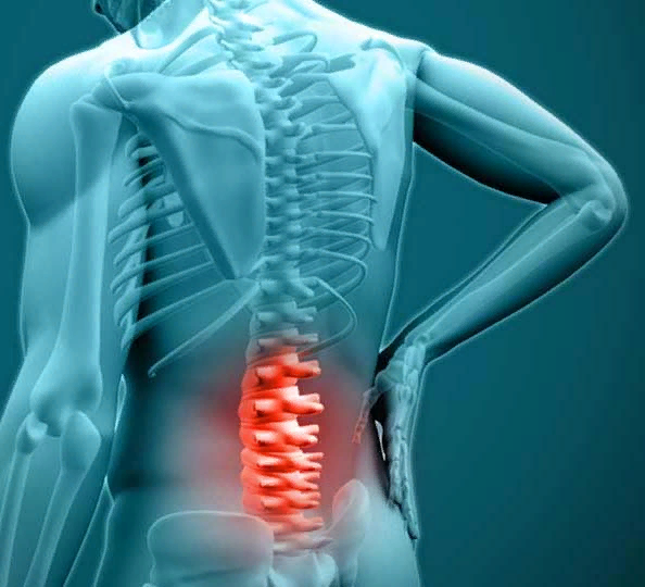 Замучила боль в спине?