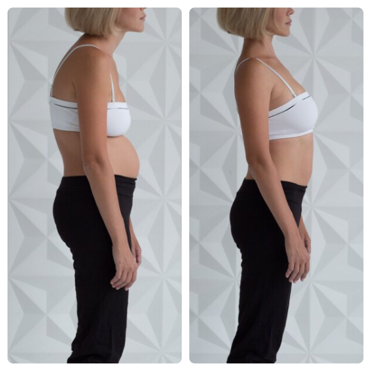 плохая осанка. осанка живот вперед. кифоз лордоз сколиоз грудного отдела позвоночника. девушка с прямой осанкой. осанка живот вперед.