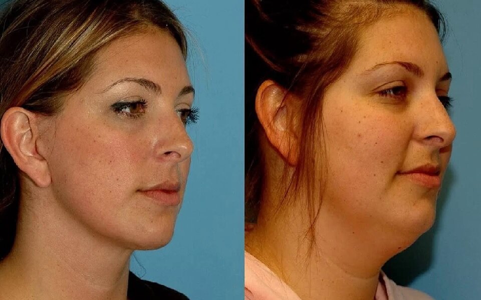 источник изображения - группа в ОК https://ok.ru/group55182152761552