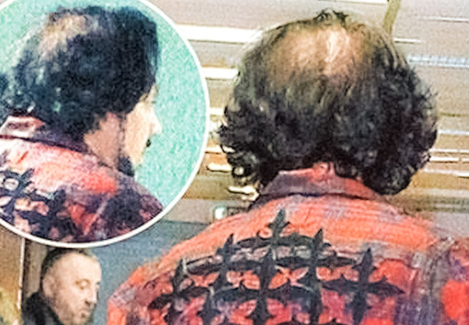 Вот почему он частенько ходит в кепочке. 