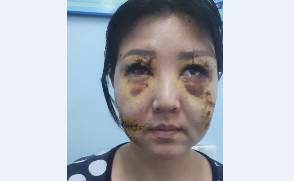  ДМИТРИЙ МАТВЕЕВ Пятница, 03 Апр 2020, 13:25