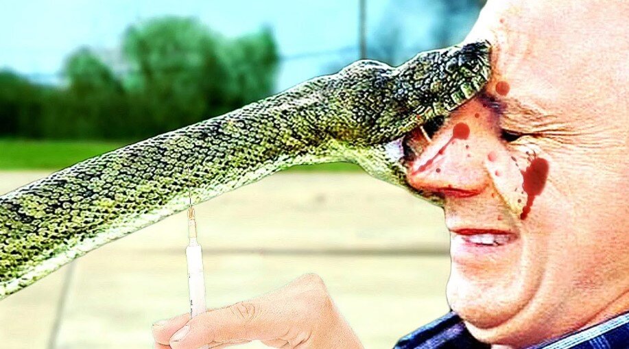 Какая нужна первая помощь при укусе змеи?