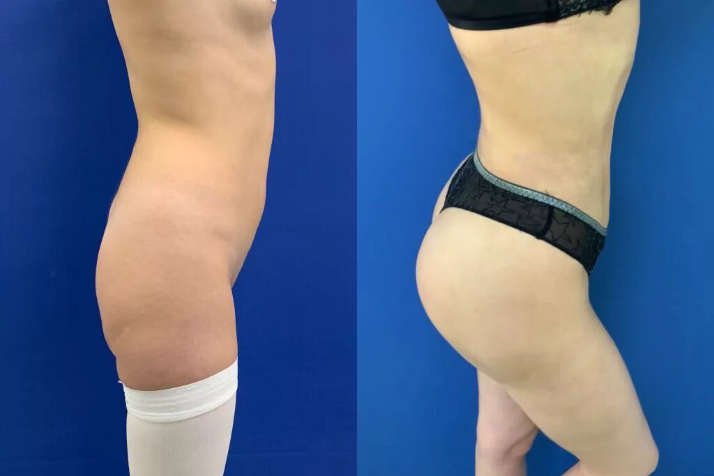 Оперировал пластический хирург Лупин Данила Александрович