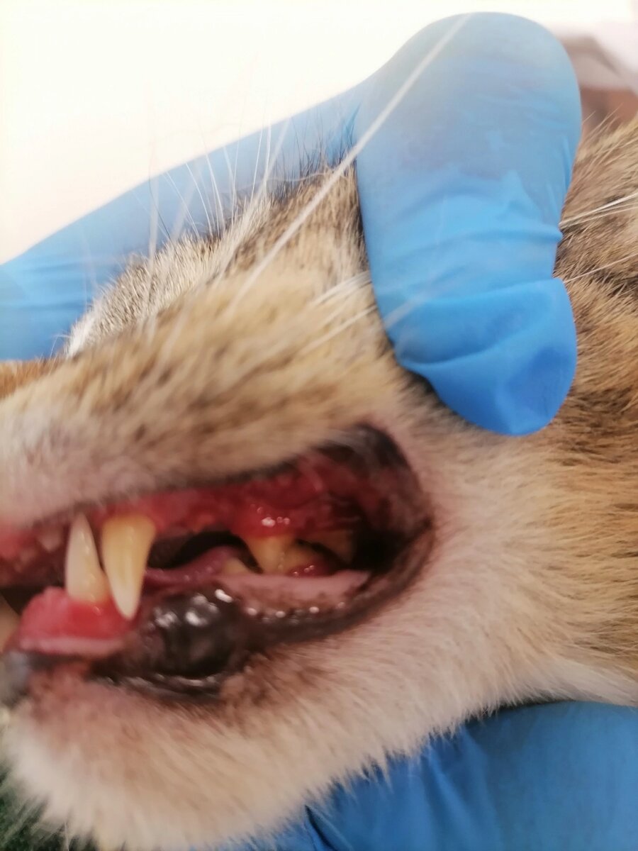 
Хронический гингивостоматит кошек – представляет собой хроническое тяжелое воспаление десен и слизистой оболочки, обычно локализующееся в задней части ротовой полости. Но иногда поражаются и другие области ротовой полости, например язык или нёбо. Хронический гингивостоматит является достаточно распространенной проблемой у кошек и может представлять очень изнурительное состояние, существенно влияя на повседневную жизнь животного.

Причины.
Хронический гингивостоматит обуславливается многофакторной этиологией, а это означает, что болезнь вызывает ряд причин в комбинации, а именно инфекционные, аутоиммунные факторов и факторы окружающей среды. Хотя точный механизм возникновения гингивостоматита кошек до сих пор не выяснен. Предрасполагающим фактором данного заболевания считаются бактерии зубного налета.

Симптомы.
Клинические признаки гингивостоматита, могут включать:

воспаление части или всей слизистой оболочки полости рта;
глоссит;
воспаление тканей ротоглотки и перидонта;
генерализованное и/или локализованное язвенное и/или пролиферативное воспаление десен;
дискомфорт в полости рта при жевании, глотания или вылизывании;
анорексия или потеря веса, или кахексия;
повышенное слюноотделение;
неприятный запах изо рта;
выраженное покраснение слизистой ротовой полости.
Лечение.
Лечение хронического гингивостоматита кошек производится хирургическим или медикаментозным методом.

Хирургическое лечение.

Данный терапевтический подход к хроническому гингивостоматиту заключается в устранении всех источников инфекции и хронических воспалительных процессов.

Медикаментозное лечение:

Антибиотикотерапия: наиболее часто используемые препараты включают амоксициллин-клавулановую кислоту, клиндамицин, доксициклин и спирамицин-метронидазол, азитромицин;
Нестероидные противовоспалительные средства (НПВС): можно использовать незначительный период времени для контроля болевого синдрома, но не более 10-14 дней;
Кортикостероиды: преднизолон часто используется в качестве препарата короткого действия для контроля воспаления;
Циклоспорин: является иммунодепрессантом, который оказывает свое действие за счет ингибирования активации Т-клеток, снижения экспрессии интерлейкина-2 и увеличения числа Т-клеток в организме;
Рекомбинантный кошачий интерферон омега (ИФН): представляет собой группу сигнальных белков, способных препятствовать репликации вируса;
Мезенхимальная терапия стволовыми клетками (МСК): МСК подавляют пролиферацию активированных Т-лимфоцитов;
Полисахариды: представляют собой природные разветвленные или неразветвленные полимеры, состоящие из моносахаридов, соединенных гликозидными связями. Они обладают антиоксидантными, противовоспалительными, противовирусными и иммуннокоррегирующими свойствами, что обосновывает их применение в качестве лекарственного средства. Местное применение полисахаридов стимулирует пролиферацию клеток через сигнальный путь ERK1/2, а также пролиферацию фибробластов десен и ингибирует рост Porphyromonas gingivalis, Actinomyces aggregatum, Clostridium nucleatum, Porphyromonas gingivalis.