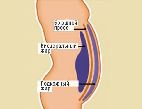 Жир в области талии опаснее лишних килограммов в других местах