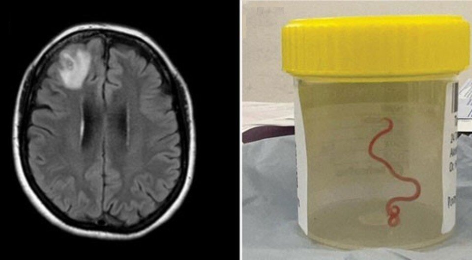   Sanjaya N. Senanayake et al. / Emerging Infectious Diseases, 2023