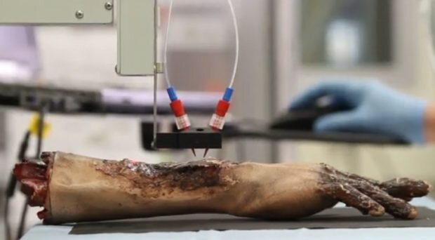 3D принтер наносит клетки кожи на рану. Это не человеческая рука, а протез. Снимок экрана: Видео Уэйк Форест, Институт регенеративной медицины (WFIRM)
