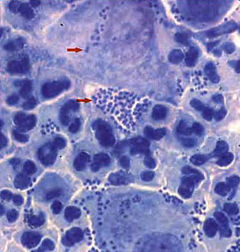 N.gonorrhoeae. Мазок из гноя. Окраска метиленовым синим
