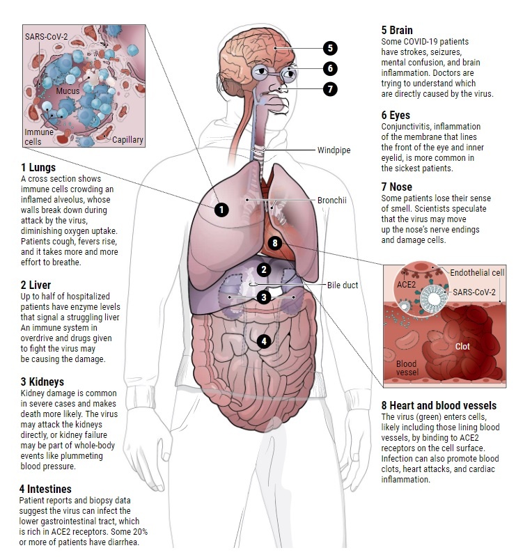 Что именно поражает вирус. 