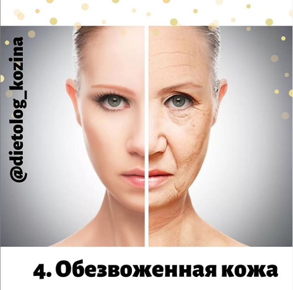 Увлажняемый слой