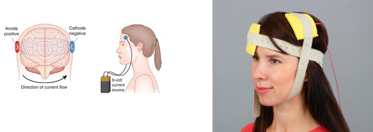 tDCS. Принцип работы