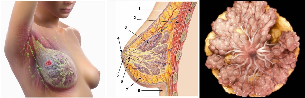 Есть ли теле. Бластома молочной железы. Диффузный фиброаденоматоз. Эктазия молочных протоков. Фиброзно кистозный мастит.