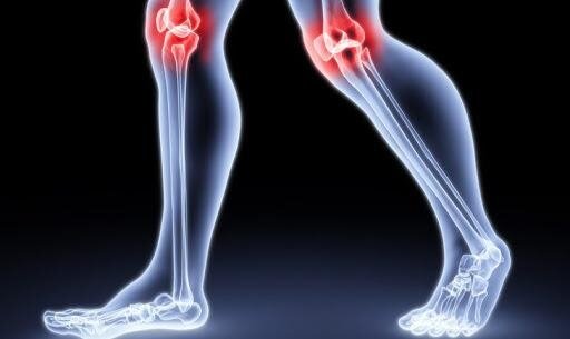 Артроз. Как, чем и сколько его лечить? Вопрос-ответ доктору Бубновскому ...