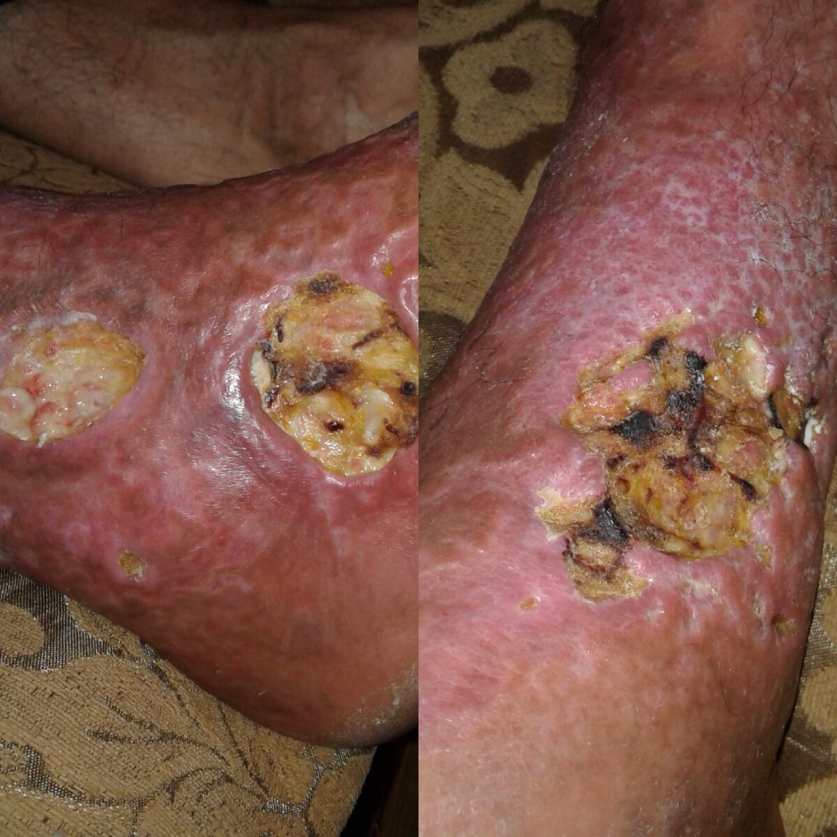                                                                      Ужасы реальности😬😬😬      