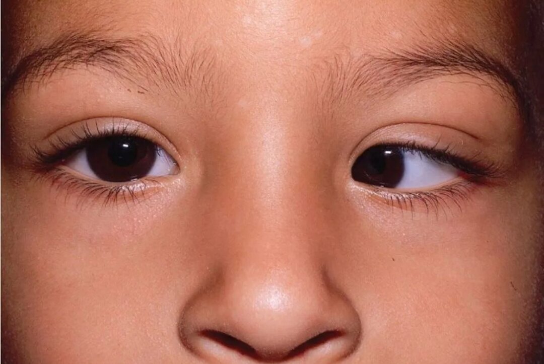 Фото из интернета .Моих личных фото в детстве нет в наличии.