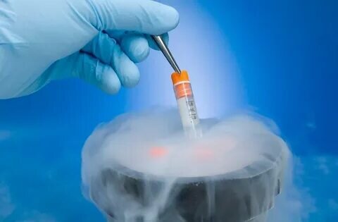 Криоконсервация спермы, замораживание сперматозоидов Киев | «Айвимед»