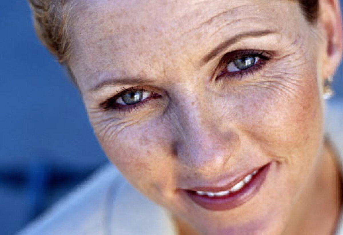 Возрастные дефекты кожи. ВиталисЛаб