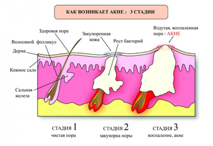 Как гормоны влияют на кожу