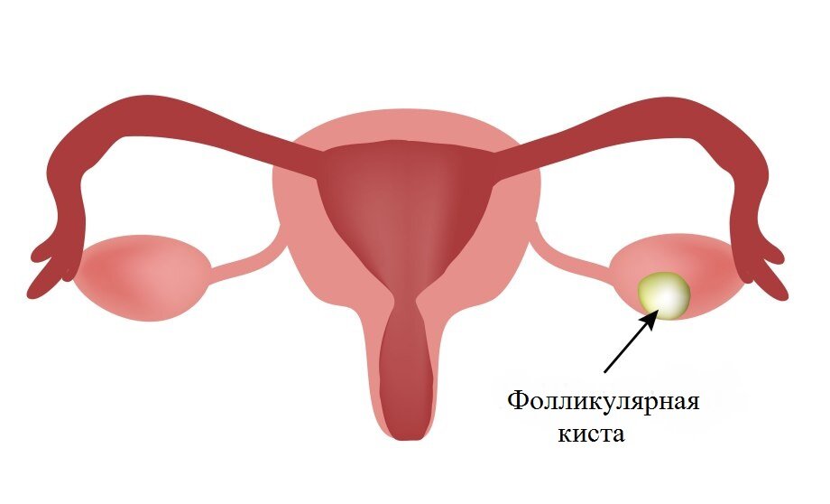 Как может повести себя фолликул