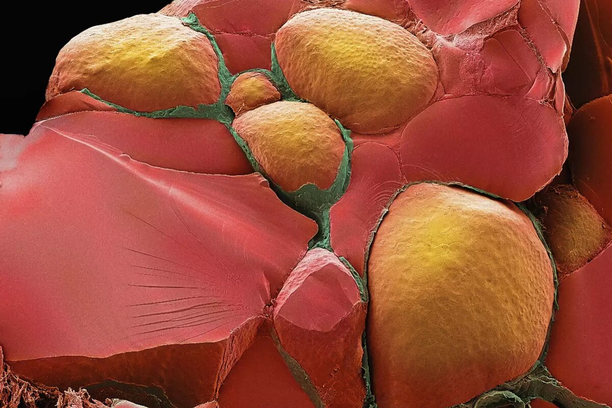  Это сканирующая электронная микрофотография (SEM) перелома через щитовидную железу с выявлением нескольких фолликулов (оранжевого и зеленого). Между фолликулами находится соединительная ткань (красная). Стив Гшмайснер / Научная фототека / Getty Images