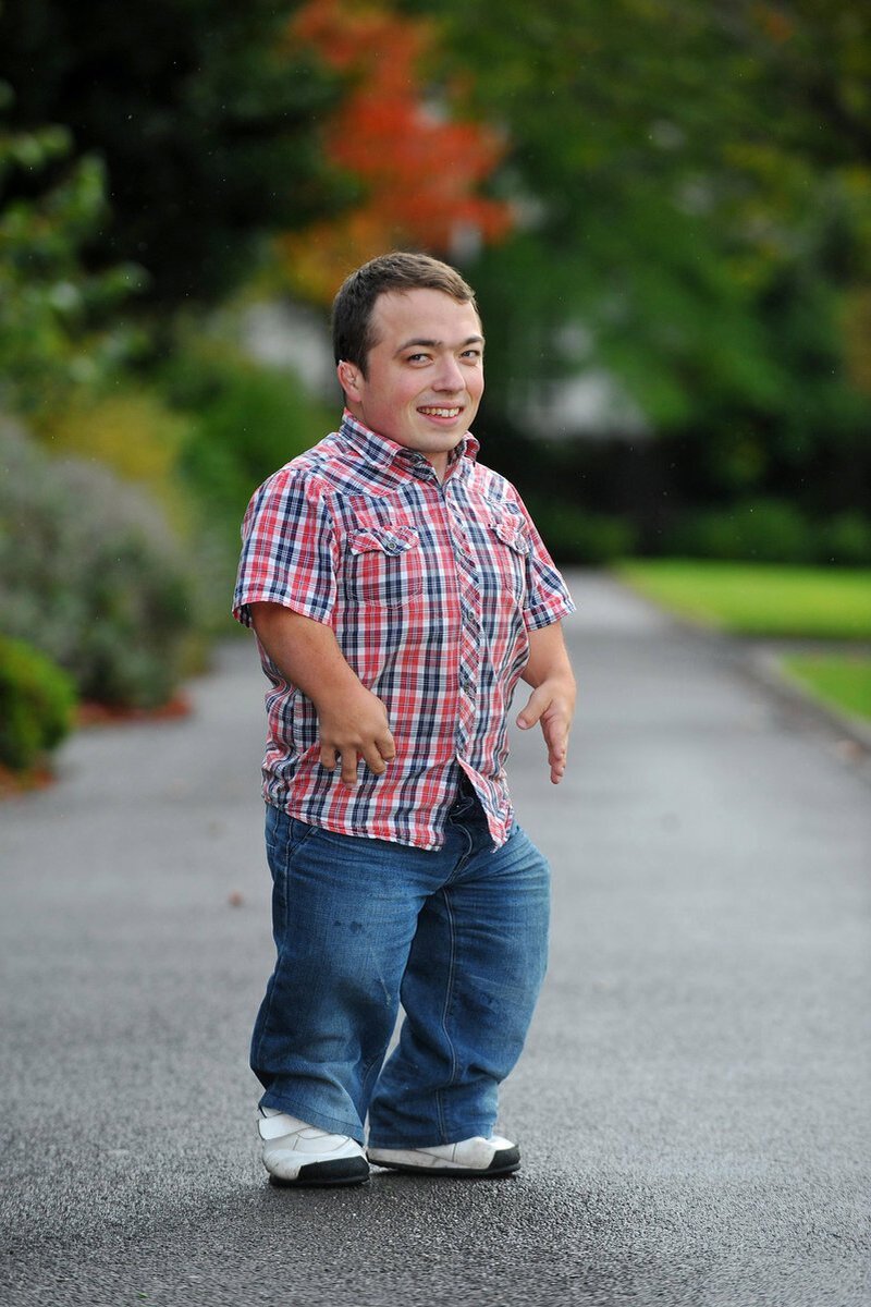 Как называется карликовость. Как называется карликовость. Как называется карликовость. Как называется карликовость. Джоти амджи.