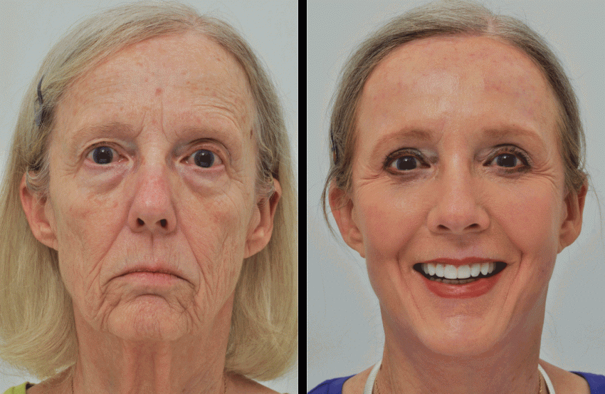 Источник: fitnessadvice.ru