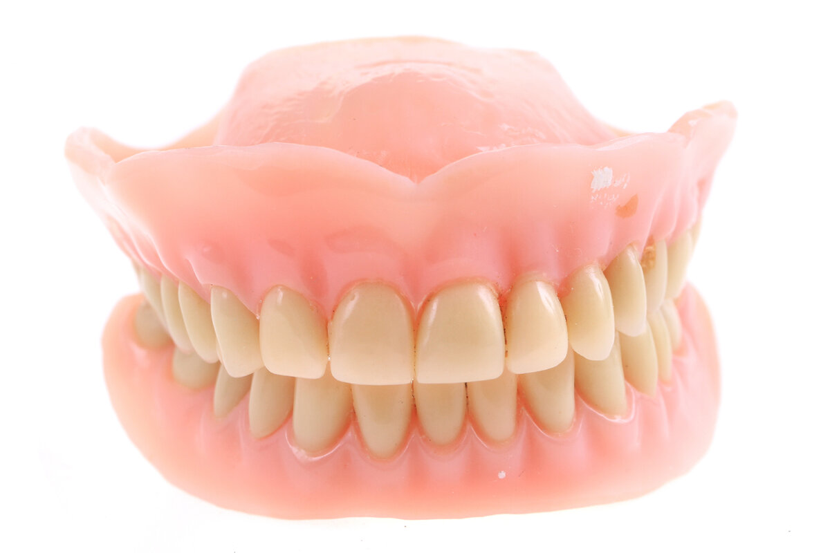 Процесс восстановления переднего зуба разрушенного супер клеем
